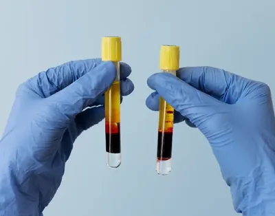 platelet rich plasma injection procedure for tendon injury recovery in queen creek az