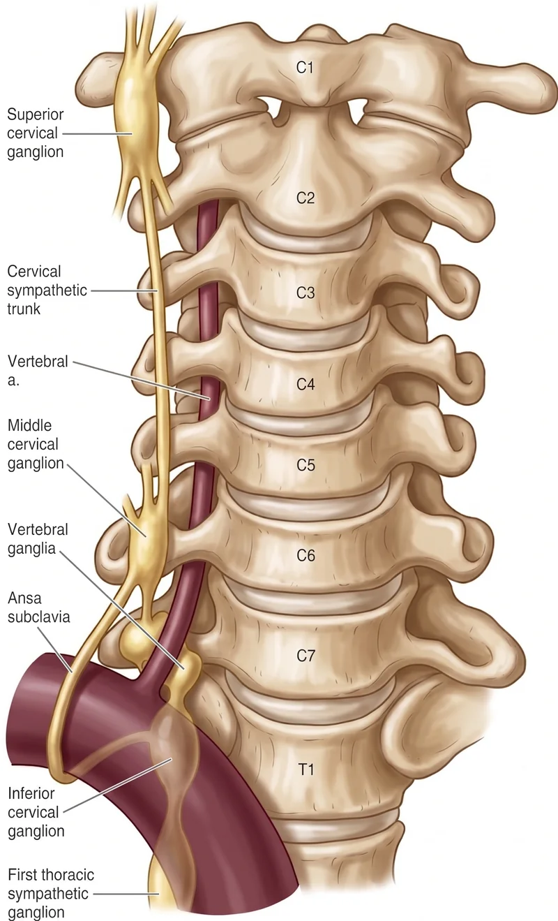 Anatomical diagram of the cervical sympathetic chain showing the C4 and C6 injection levels used in a two-level stellate ganglion block